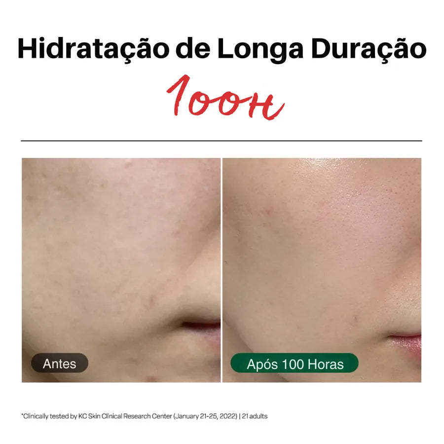 Dr G Red Blemish Hidratante Facial Calmante para Peles Sensíveis, Acneicas e Irritadas - foto 2