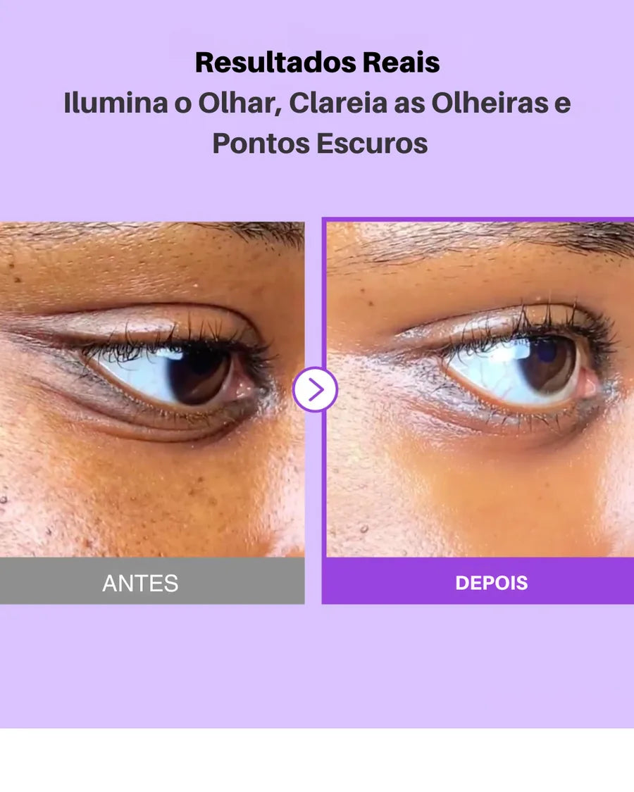 Creme para Área dos Olhos Numbuzin No.9 - NAD+ + Retinol para Olheiras, Rugas e Linhas Finas | Peptídeos & Niacinamida - foto 2