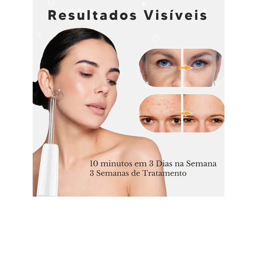 Aparelho de Alta Frequência DARSONVAL- 6 em 1, Terapia Facial Anti Sinais, Acne e Cabelo - foto 2