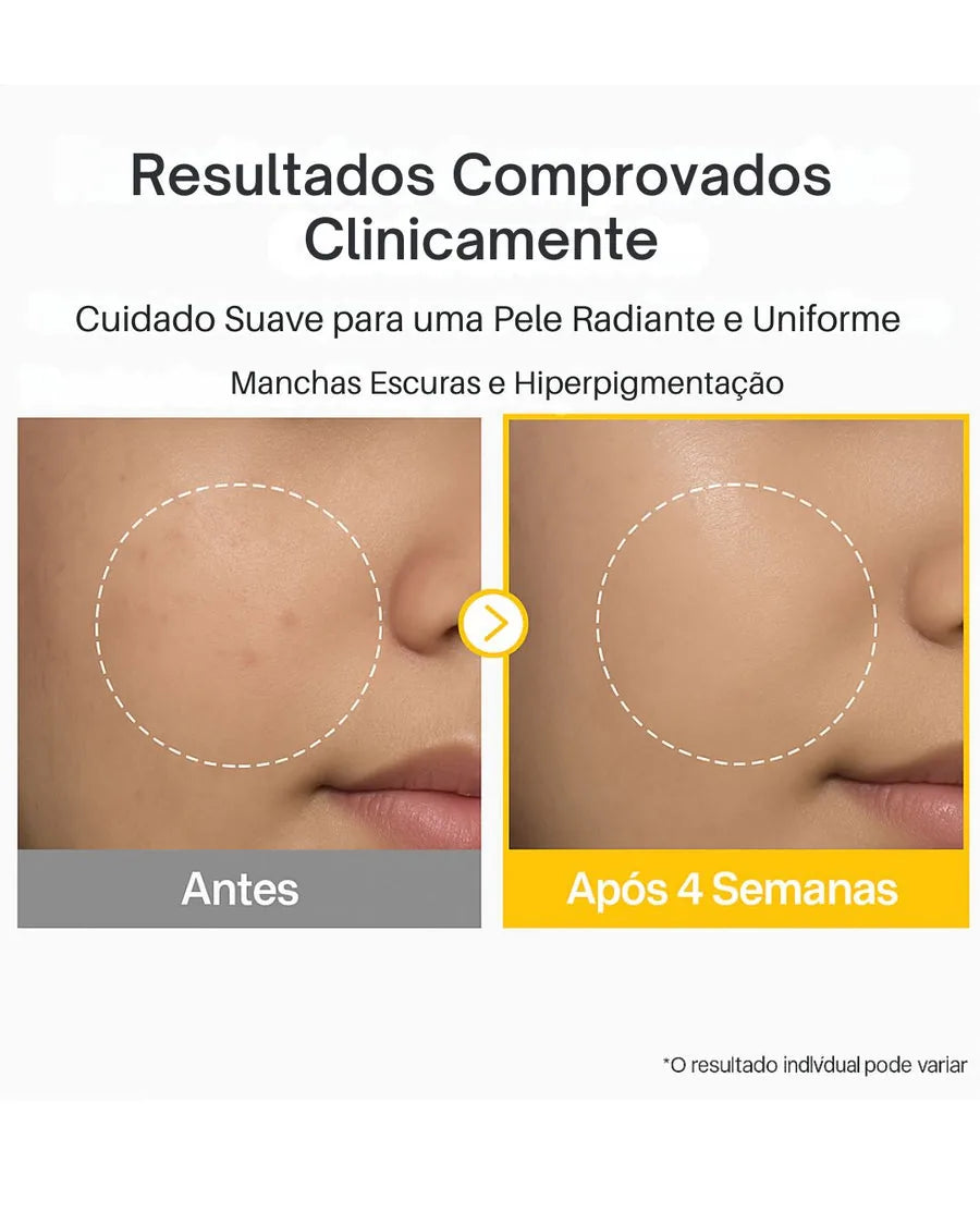 numbuzin No.5 Vitamin Concentrated Serum | TXA 4% + Niacinamida 5% com Glutationa e Vitamina C - foto 2
