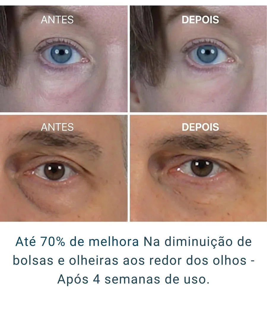 Eyephalt Eye Cream Dr. Melaxin - Hidratante para Olheiras, Bolsas e Inchaço com Bio-Spicule, EGF e Niacinamida - foto 3