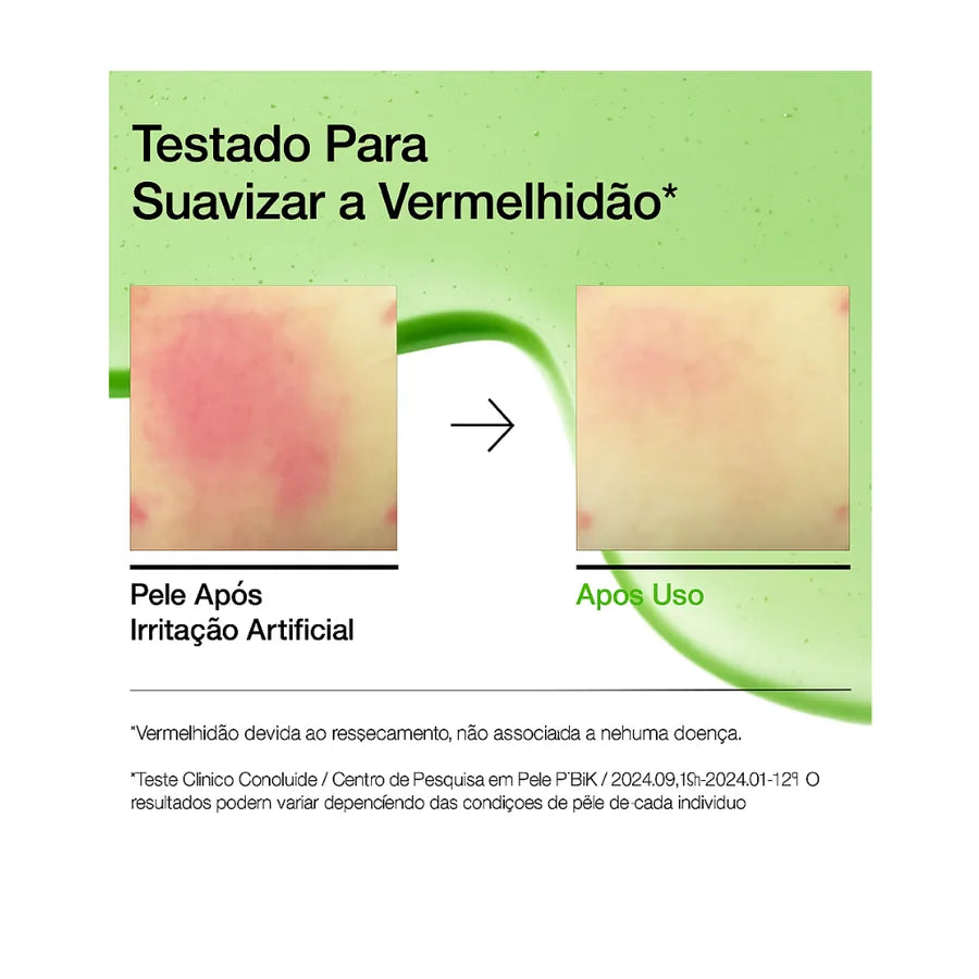 Anua Sérum Facial com Ácido Azelaico 10%, Pantenol e Ácido Hialurônico para Tom, Textura e Oleosidade - foto 3