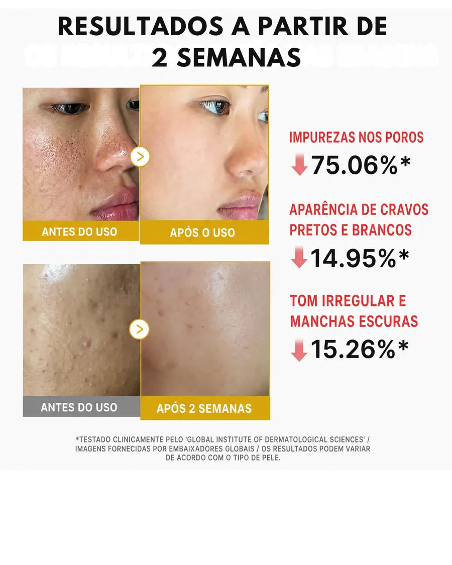 Medicube Peel Shot com Ácido Kójico, Cúrcuma, BHA, LHA e PHA - Sérum Esfoliante para Cravos, Oleosidade e Poros - foto 3