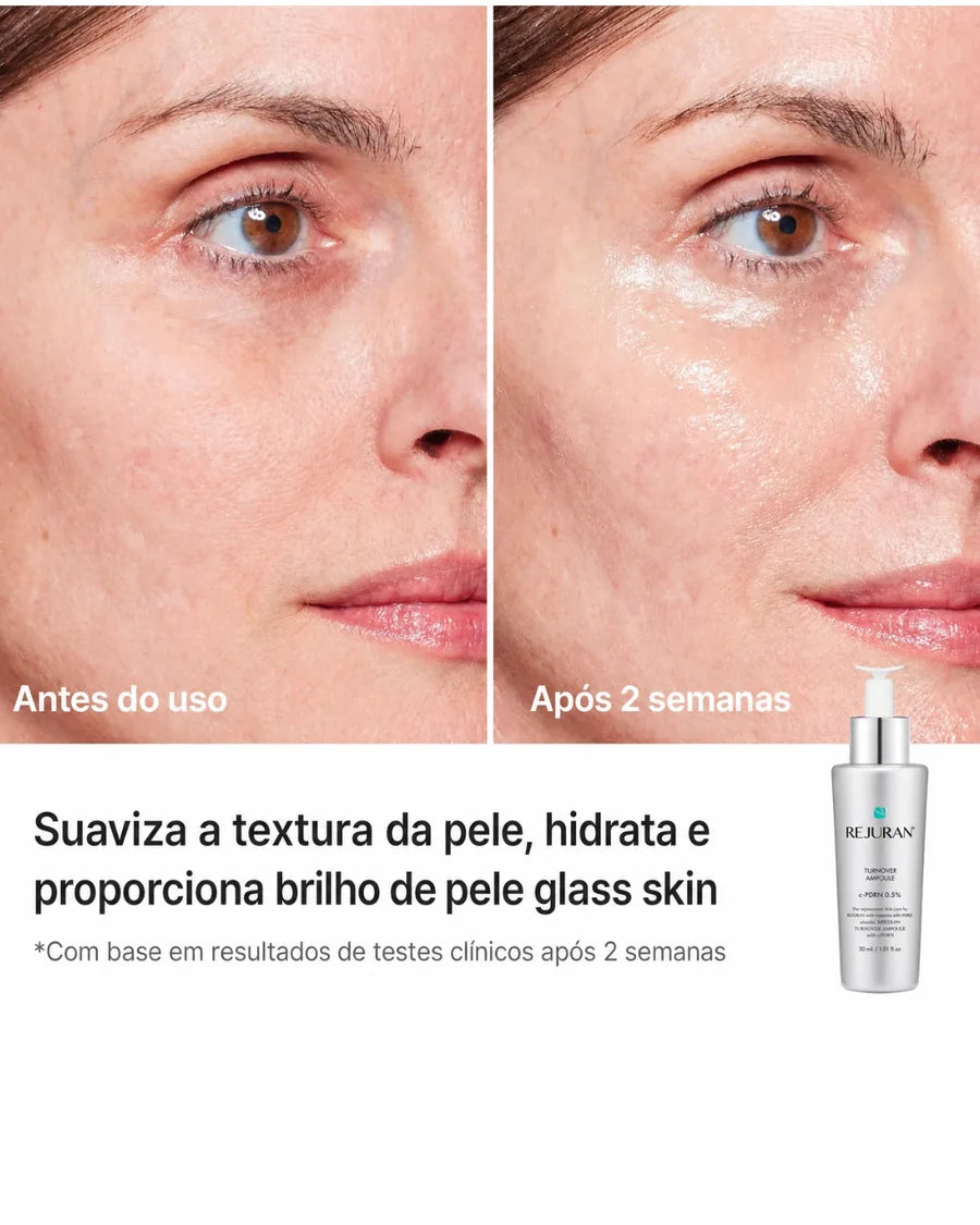 REJURAN Turnover Ampoule c-PDRN - Sérum Facial para Hidratação, Luminosidade e Textura - foto 3