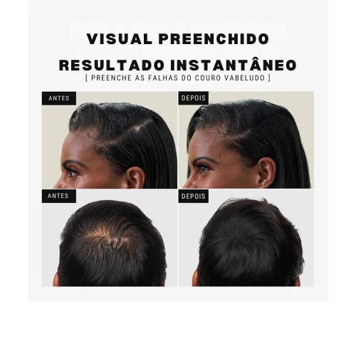Fibra Capilar Toppik 27,5g - Disfarce de Falhas, Volume e Densidade Instantânea - foto 3