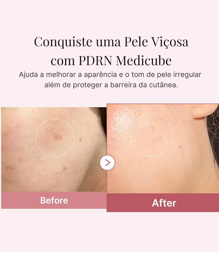 Medicube com Ácido Hialurônico Creme Hidratante Rosa PDRN | Recuperação de Imperfeições e Hidratação Profunda - foto 3