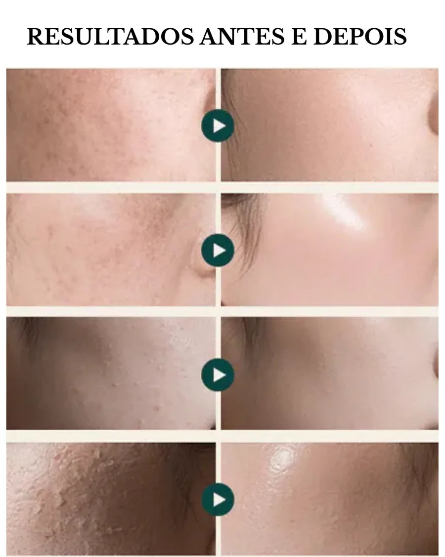 Dr.Reju-All Advanced PDRN Cream com Niacinamida e Pantenol para Hidratação, Firmeza e Textura - 20 ml - foto 3
