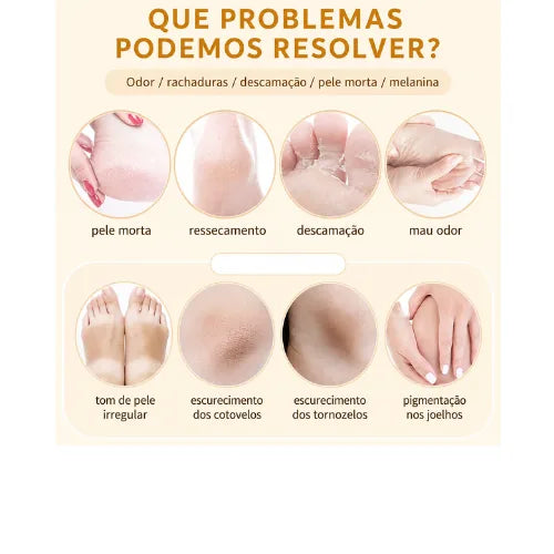 Spray Peeling para Pés com Óleo de Laranja - Removedor de Pele e Calosidades, Esfoliante e Amaciante Pés - foto 3
