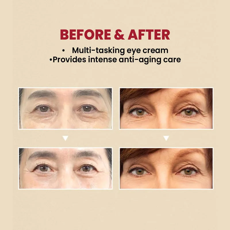 Creme para Área dos Olhos SEOUL 1988  com Retinal 4% Com Peptídeos e Bakuchiol - Ação Anti Sinais e Firmeza - foto 4