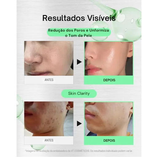 VT COSMETICS CICA Reedle Shot 700 - Sérum de Microagulhamento em Creme com Espículas e Exossomos - foto 4