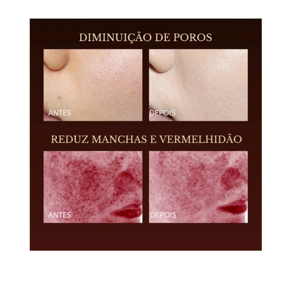 Máscara Facial LED Terapia Photon High 7 Cores em Silicone com 110 Leds - Anti Sinais - foto 6